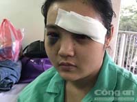 Nghi án tố giác tội phạm, thiếu nữ 16 tuổi bị 20 tên côn đồ hành hung dã man ở Sài Gòn